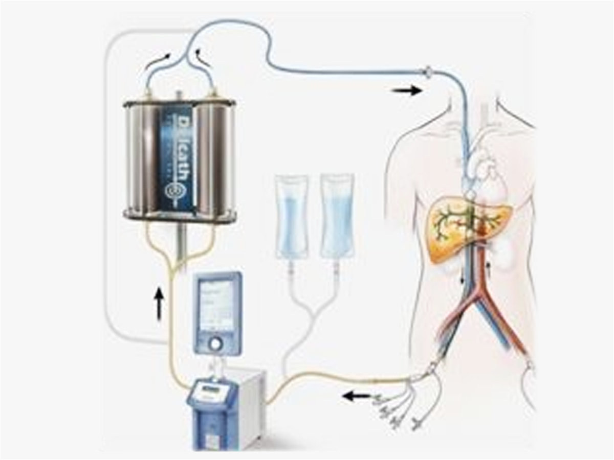 供體灌注管路套包